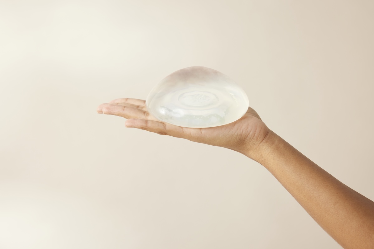 mellplasztika, döntési szorongás, mellimplantátum biztonság, Esztétika Expo 2026, kapszuláris kontraktúra, szilikongél kohézió, CEREFORM®, esztétikai sebészet, implantátum szakadás kockázata, páciens tájékoztatás